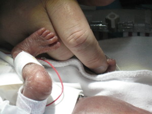 James held on to a finger and brought his foot over to feel Daddy's hand. He loved our touch.