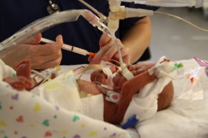 James receiving 2 cc's of breast milk through his NG tube.