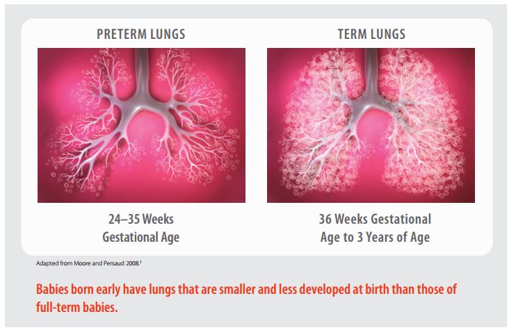 preemie lungs vs full-term lungs