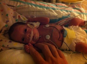 Evelyn, with a feeding tube