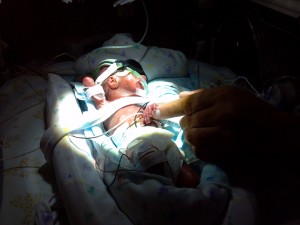 micro preemie baby in NICU