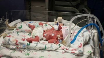 baby in NICU