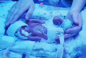 Our son Gabriel, a day after being born at 22 weeks and 6 days of gestation in 2012. He is under a bilirubin light to help break down toxins in his skin that his liver was too immature to deal with.