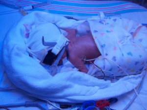 How A Preemie Birth Affected My Relationships