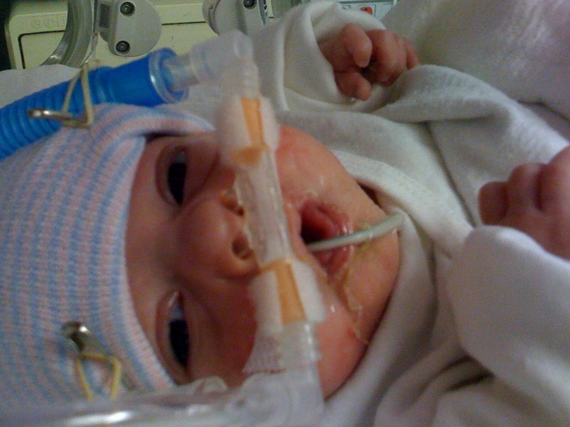 Isolation, From Your Preemie’s Point of View