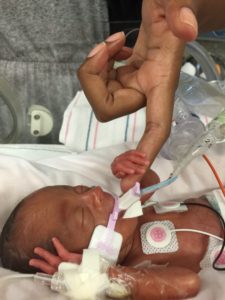 10 Things Every Preemie Parent Should Know