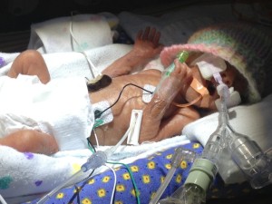 Life in the NICU: A Stressful Situation