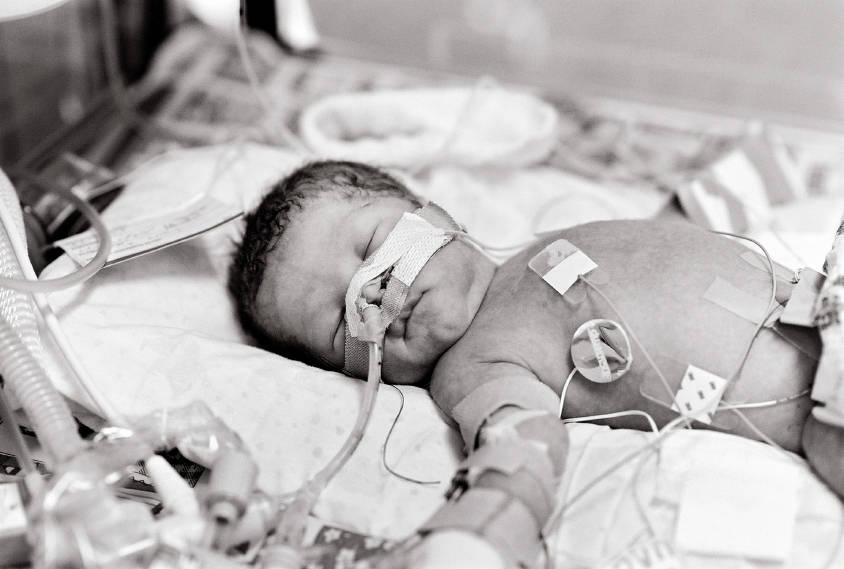 Coming to TERMs with the NICU