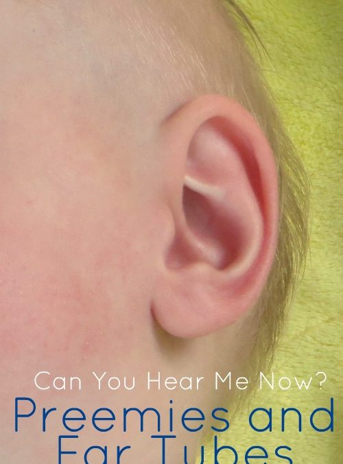 Can You Hear Me Now? Preemies and Ear Tubes