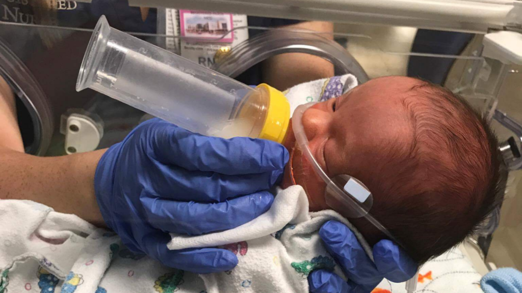 NICU baby feeding from bottle, human milk fortifier in the NICU