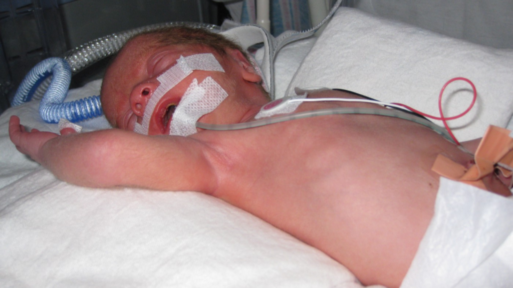 NICU baby, NICU support, NICU parent, preemie baby