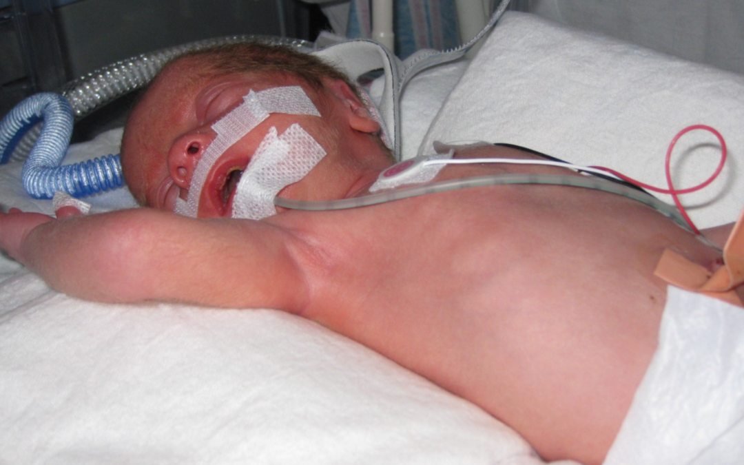 NICU Parent Perspective: Glimmers of My Early Treasures