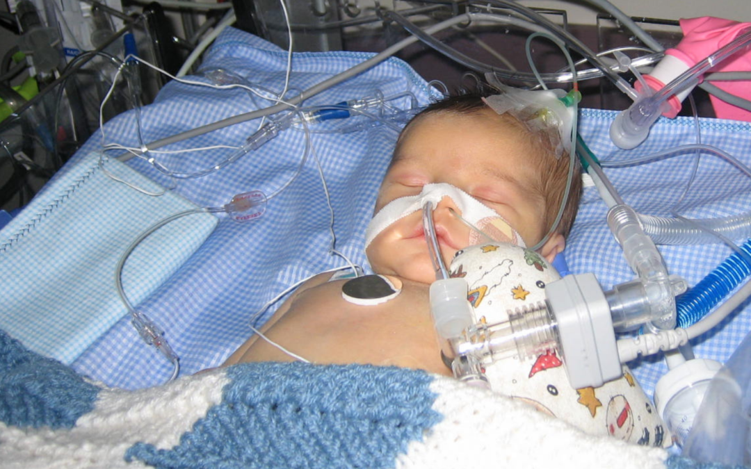 A Second NICU Stay; an Unexpected Heart Surgery