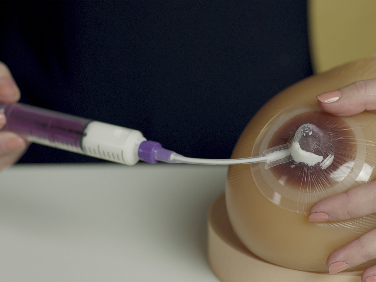 Neotech Bridge, Neotech Products, supplemental nursing system, supplementation while breastfeeding