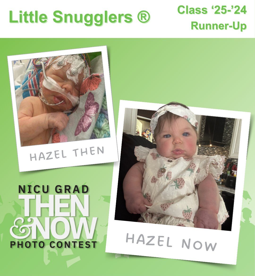 hand to hold nicu then and now photo contest 