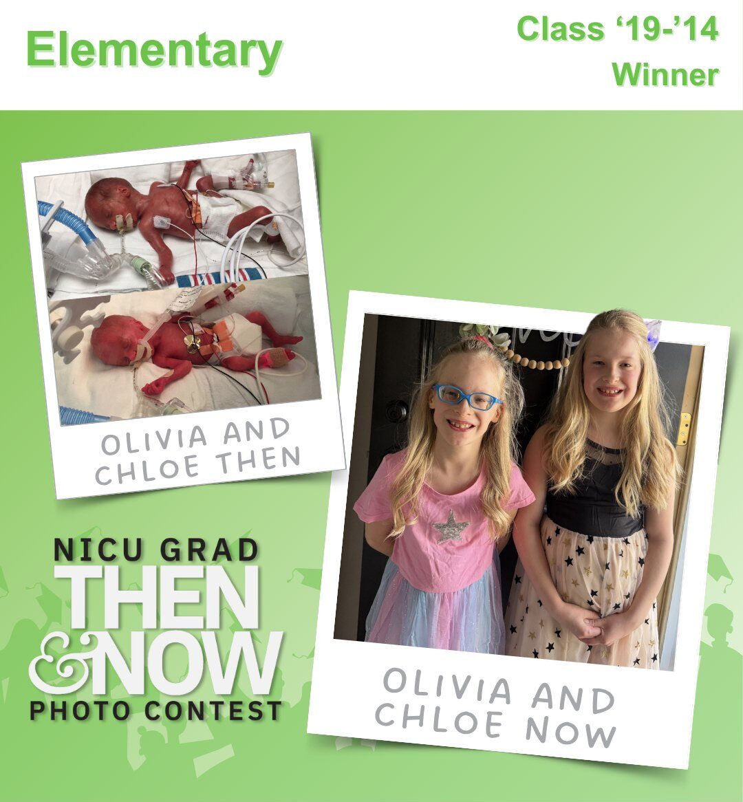 hand to hold nicu then and now photo contest 