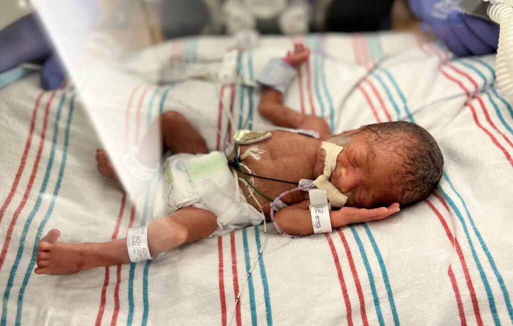 long nicu stay, hand to hold, micro preemie