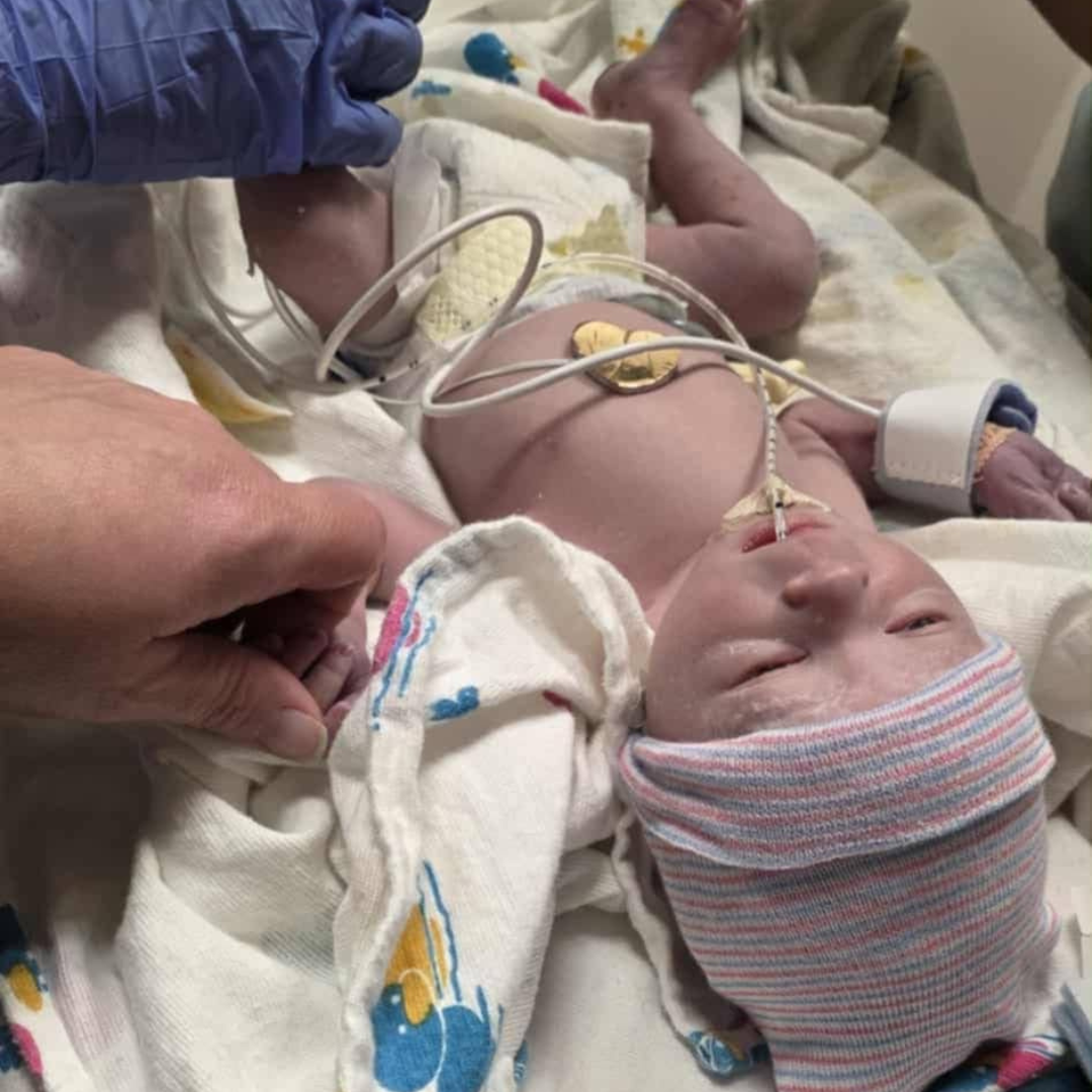 nicu baby, hand to hold, informed consent